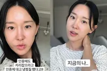 ¿El secreto para verse más joven? ¿La cirugía de reducción de labio superior de Lee Ji-hye, sin efectos secundarios?