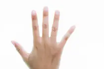 Predicting a Rare Disease from the Back of Your Hand: AI Breakthrough in Acromegaly Detection