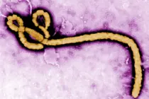 d la expansión acelerada de Ebola... ¿Hasta dónde ha llegado el desarrollo de una nueva vacuna y tratamientos?