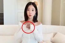 Hurt by Malicious Comments, Actress Ki Eun-se Reveals Bruised Hands After Anti-Aging Procedure