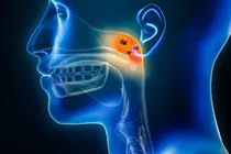 U não có thời gian sống trung bình 15 tháng: Thuốc điều trị, đưa qua đường mũi liền mang lại sự khác biệt 