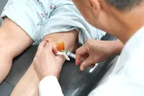 Arthrose du genou : le traitement par SVF réduit la douleur en trois semaines et pourrait retarder la pose d’une prothèse