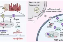 不喝酒也会“肝变硬”？代谢异常相关脂肪性肝炎治疗迎来关键突破