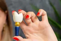 The Hidden Vulnerability of Dental Implants: Why Tough Foods Can Snap Your New Teeth