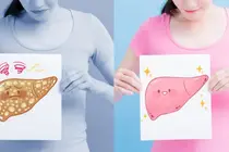 Silent Toll: Severe Depression Linked to Higher Fatty Liver Risk in Young Women