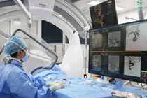 Anévrisme cérébral difficile à traiter : l’hôpital Asan de Seoul utilise pour la première fois en Corée un nouveau dispositif