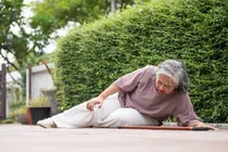 Why Bones Break Before Osteoporosis Sets In: The Hidden Risk Behind Normal Scans