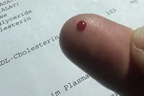 Normal Cholesterol Panel? Why You Might Still Need an Lp(a) Test