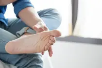 Beyond Itchy Feet: How Summer Humidity Triggers Recurrent Fungal Skin Infections