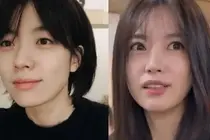 Han Hyo-joo et Kim Kang-woo visés par des rumeurs de « chirurgie des paupières » : le regard peut-il changer sans opération ?