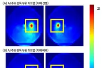 Routine Eye Photos Can Flag Current Dementia and Predict Future Risk, AI Study Finds