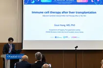 Immuncell-LC Demonstrates Potential in Preventing Liver Cancer Recurrence Following Organ Transplant