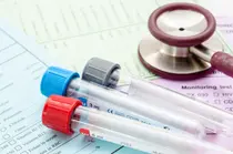 « Résultats d'examen flous ? »... Trop de gens ignorent ce chiffre dans les tests sanguins !