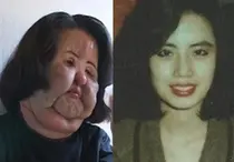 « C'était si beau... »... 'Auntie Ventilateur', qu'a-t-elle mis sur son visage ?
