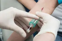 90% Genetic ‘Lipoprotein’… Can the High Risk of Heart Attack Be Reduced?