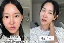 « Le secret pour paraître plus jeune ? » La réduction de la longueur du philtrum de Lee Ji-hye, sans effets secondaires ?