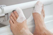 Bệnh chân tiểu đường, cuối cùng có phải cắt bỏ không?… Còn con đường khác