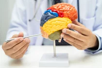 “Loại bỏ 65% protein gây bệnh Alzheimer mà không cần thuốc” siêu âm, có thể trở thành hy vọng mới?