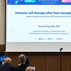 Greffe du foie : l’immunothérapie cellulaire possible sans augmenter le risque de rejet aigu