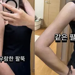 Actor Kim Ha-young Reveals Post-Liposuction Results After Removing 1,700 cc of Upper-Arm Fat