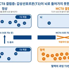 FDA批准MCT8缺乏症首款疗法：甲状腺激素“脑内不足、全身过量”的罕见遗传病迎来新药