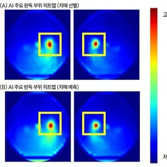 Routine Eye Photos Can Flag Current Dementia and Predict Future Risk, AI Study Finds