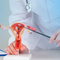 Endometriosis Recurs in Up to 50% of Patients Within 5 Years, Expert Warns
