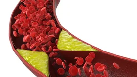 A Major Paradigm Shift in Cholesterol Management: Earlier Testing, 30-Year Risk Predictions