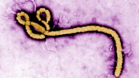 Ebola spreads rapidly in DRC—how far have new vaccines and treatments come?