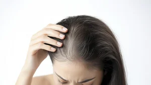 女性到了一定年龄后，脱发问题加重：主要原因三种