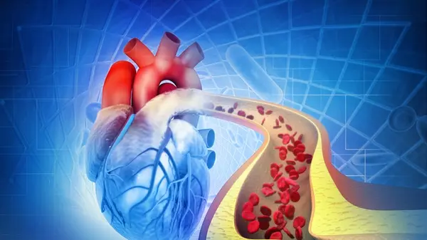 Khối u tim sau nhồi máu cơ tim kiểm soát cholesterol nhanh hơn: Thuốc điều trị RNA gây chú ý 