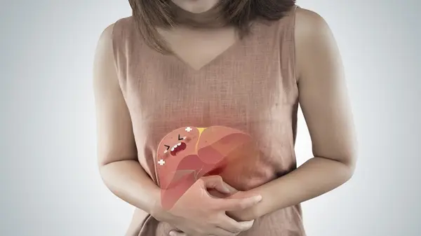 「脂肪肝改善の手がかりは腸に？ 食物繊維成分の意外な可能性」