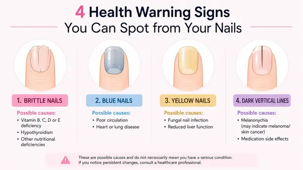 Taches, stries noires… Quatre signaux d’alerte à repérer sur les ongles