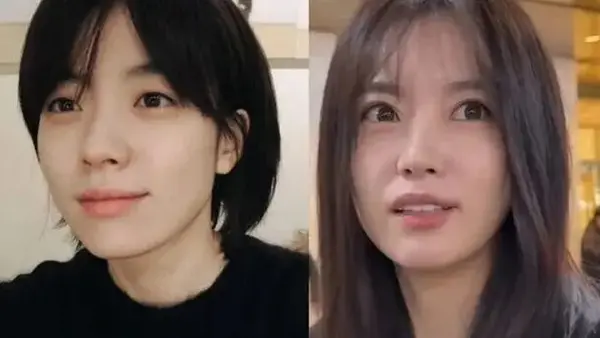 Did Han Hyo-joo and Kim Kang-woo Get Eye Surgery? How Eyes Can Change Naturally Over Time