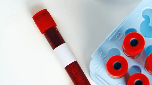 The Blood Cancer Decoy: Why Some Lymphoma Patients Stop Responding to Treatment