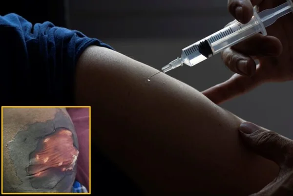 「鎮痛剤を打ってお尻の皮膚が腐った」…51歳男性の『この症候群』の苦痛、何なのか？