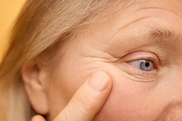 “Trông già hơn cả tuổi thật”… Nếu có nhiều nếp nhăn ở ‘đây’ thì nguy cơ mắc bệnh Alzheimer cao hơn?